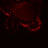 Thumbnail for dataset SuppFig5F_bcat_EGFRi-ErbB2i