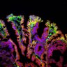 Thumbnail for dataset SuppFig7D_adenoma