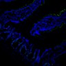 Thumbnail for dataset SuppFig7EF_20171211_Erlotinib_2