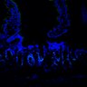 Thumbnail for SuppFig7EF_20171211_Erlotinib_3