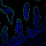 Thumbnail for dataset SuppFig7EF_20171211_Erlotinib-CHIR_5