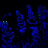 Thumbnail for dataset SuppFig7G_20170606_CHIR-Erlotinib