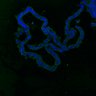 Thumbnail for dataset SuppFig8AB_Adenoma_EGFRi_2