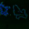 Thumbnail for dataset SuppFig8AB_Adenoma_ErbB2i_1