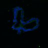 Thumbnail for dataset SuppFig8AB_Adenoma_ErbB2i_2