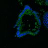 Thumbnail for dataset SuppFig8AB_normal_EGFRi_2