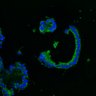 Thumbnail for dataset SuppFig8AB_normal_EGFRi_3