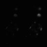 Thumbnail for dataset Figure5D_timelapse_BRET_MEKi