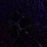 Thumbnail for dataset Figure5H_lungtumor_FRET