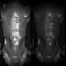 Thumbnail for dataset Figure5K_MEKi_20170426