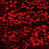 Thumbnail for dataset Figure1B_EKAREV-NLS_urothelium_FRET