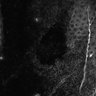 Thumbnail for dataset Figure3A_20151017_epidermis_MEKi