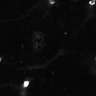 Thumbnail for dataset Figure4A_epidermis_Fucci_20161222