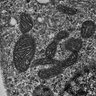 Thumbnail for dataset Fig4D_WT_MEF