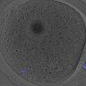 Thumbnail for dataset Fig2D_150527_pias1_cenpc_2