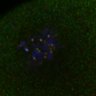 Thumbnail for dataset Fig2D_150527_pias1dn_cenpc_image27