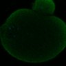 Thumbnail for dataset Fig2D_170301_interKT_pias1dn-cenpc_image9