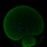 Thumbnail for dataset Fig2D_170301_interKT_pias1dn-cenpc_image49