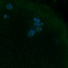 Thumbnail for dataset Fig3B_170315_Sgo2plusplus_dn_image28