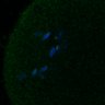 Thumbnail for dataset Fig3B_170315_Sgo2plusplus_dn_image34