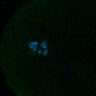 Thumbnail for dataset Fig3B_170315_Sgo2plusplus_dn_image35
