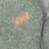 Thumbnail for dataset Fig4A-C_160701_rec8f_MII_cenpc_mut