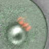 Thumbnail for dataset FigS1A_140722_mEGFP-PIAS3
