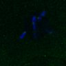 Thumbnail for dataset FigS3A_171231_MII_monastrol_cenpc_control_image10