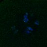 Thumbnail for dataset FigS3A_171231_MII_monastrol_cenpc_PIASdn_image39