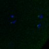 Thumbnail for dataset FigS3A_171231_MII_monastrol_cenpc_PIASwt_image29