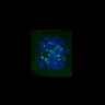 Thumbnail for FigS3C_180111_MII_cenpc_image5