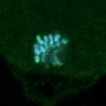 Thumbnail for dataset FigS3C_180111_MII_piasdn-cenpc_image10