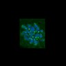 Thumbnail for dataset FigS3C_180111_MII_piasdn-cenpc_image11