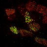 Thumbnail for dataset fig5_centrin-centriolin-vangl1_Noc