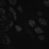 Thumbnail for dataset fig5_krt8-odf2-ZO1-Noc3h