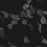 Thumbnail for dataset fig6_centrinGFP_Odf2WT