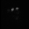 Thumbnail for Figure5D_KTtracking_20160223_L24_con2