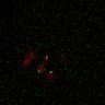 Thumbnail for Figure5D_KTtracking_misalign_20160225_L17_con3