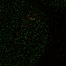 Thumbnail for dataset Figure5D_KTtracking_misalign_20160527_L9_con3