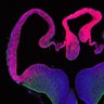 Thumbnail for dataset Fig1F_E13.5Tg_Tuj1+Pax6_edit