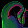 Thumbnail for dataset Fig1F_E15.5WT_Tuj1+Pax6