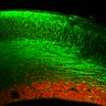 Thumbnail for dataset Fig1F_E15.5WT_Tuj1+Pax6_cation
