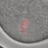Thumbnail for Figure6H_2016_4_5_2