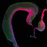 Thumbnail for dataset Fig1F_E17.5Tg_Tuj1+Pax6
