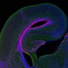 Thumbnail for dataset Fig1F_E17.5WT_Tuj1+Pax6