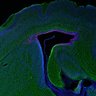 Thumbnail for dataset Fig1F_P0_WT_Tuj1+Pax6_edit