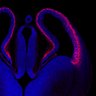 Thumbnail for dataset Fig1G_E13.5WT_Tbr2+DAPI