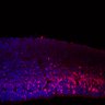 Thumbnail for dataset Fig1G_E15.5Tg_Tbr2+DAPI_highmagnification