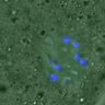 Thumbnail for dataset FigureS3A_misalign_20160225_C-Mad2_con3_5h