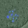 Thumbnail for dataset FigureS3A_misalign_20160225_C-Mad2_half3h